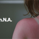 Illustration for article titled Sunburn Is Your RNA Crying Out in Pain
